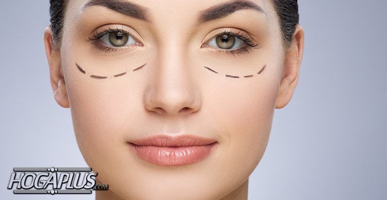 Remedies to Treat the Dark Circles Under Your Eyes